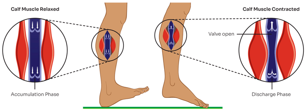 lymphatic-system-leg-pump